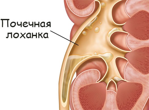 Black sprut зеркала тор